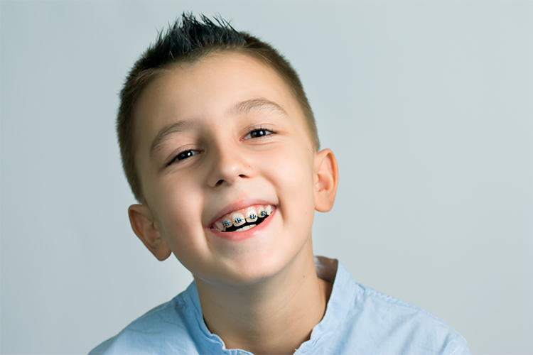 benefits of early orthodontics treatments