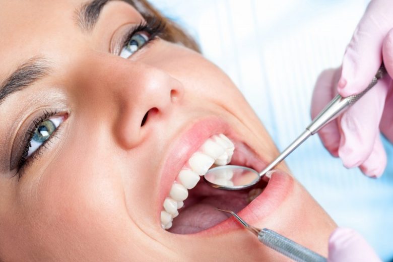 look after new fillings