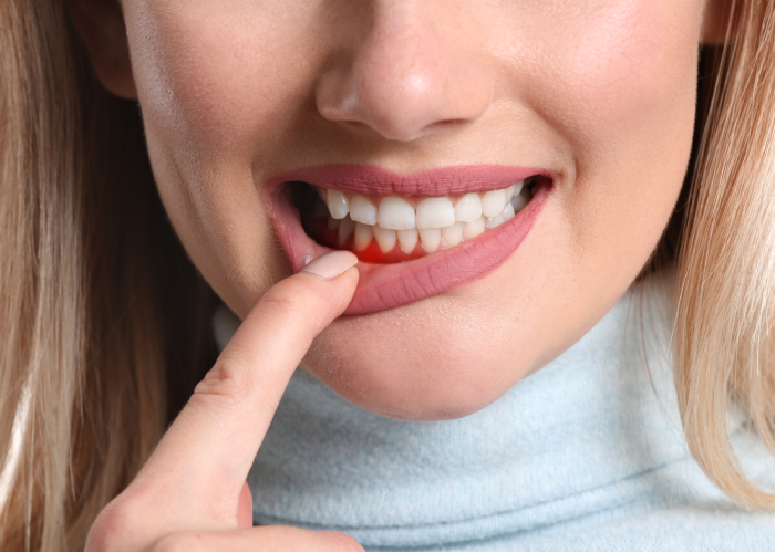 dangers of bleeding gums