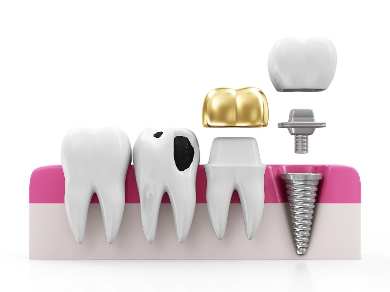 teeth, health, smile, dentist, dentalhealth, oralhealth