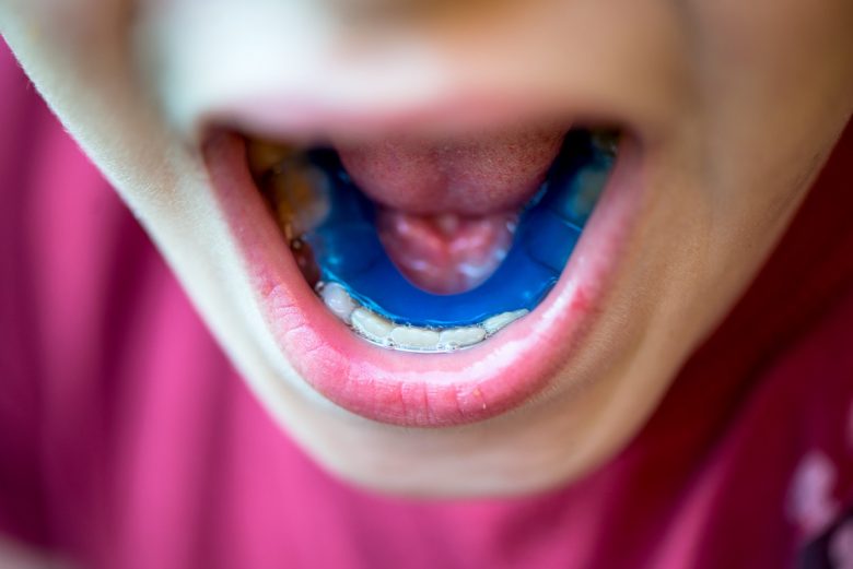 how to prevent teeth shifting after braces