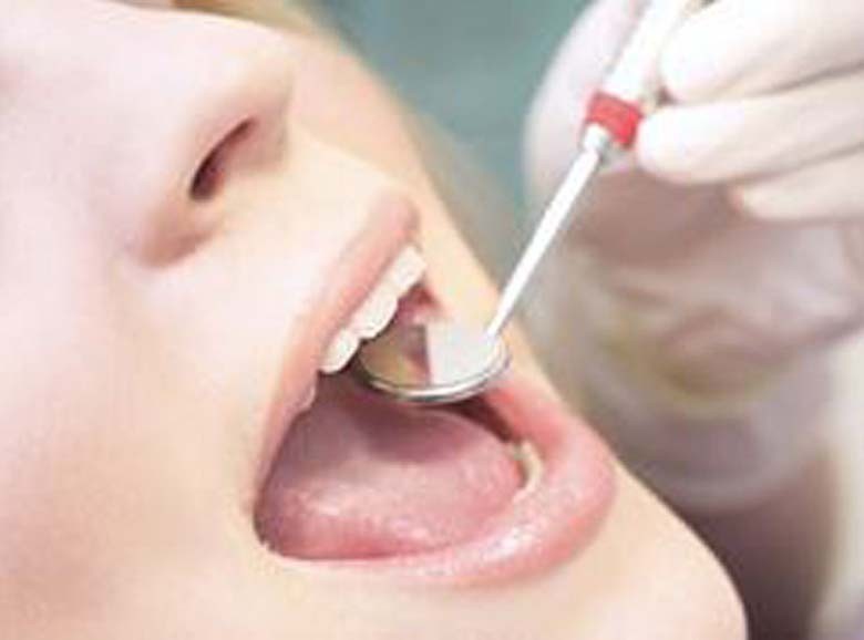 Dental Treatments York
